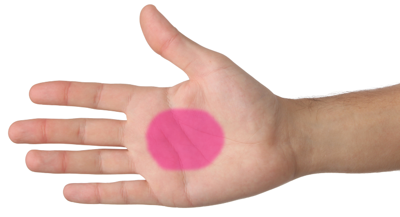 Hand mit rotem Fleck